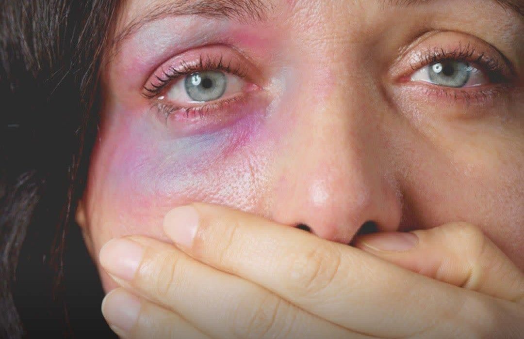 هر ۱۰ دقیقه یک زن به دست نزدیکانش کشته می‌شود